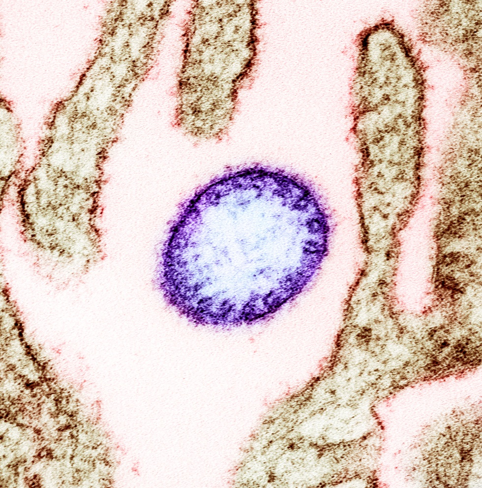 Những điều cần biết về loại virus Nipah nguy hiểm chết người - 1
